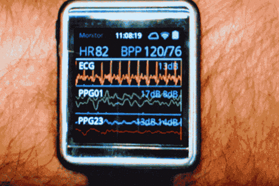 花八千多买部iPhone X后 你打算用几年? 花八千多买部iPhone X后 你打算用几年?