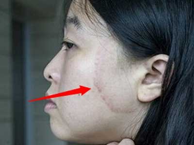 苹果为非 iPhone 15 系列机型推送 iOS 17.0.2 更新 苹果为非 iPhone 15 系列机型推送 iOS 17.0.2 更新