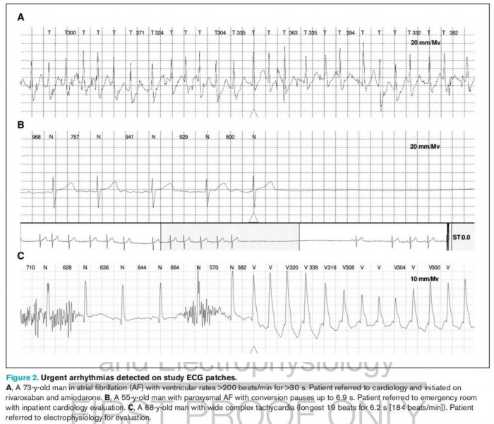 苹果 Apple Music 宣布为五款梅赛德斯-奔驰汽车提供空间音频支持